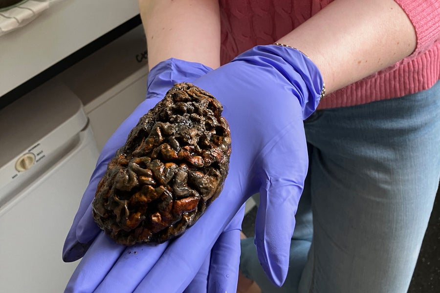 Photo of preserved brain at University of Oxford being held by gloved hands