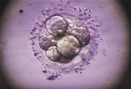 IVF embryo, light micrograph